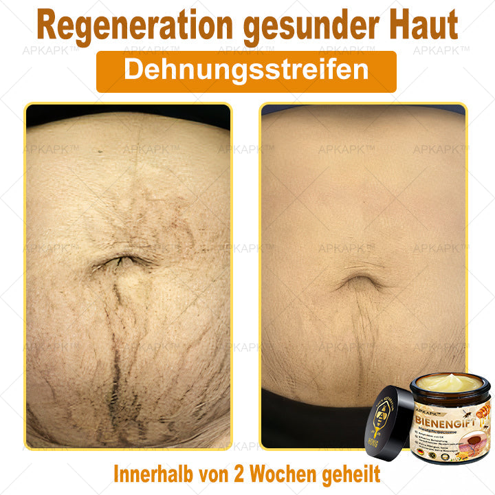 Hautgeprüfte Zertifizierung | 🥇🥇 APKAPK™ BIENENGIFT Hautpflegecreme ( 🔥Letzter Tag der Aktion 80% Rabatt)