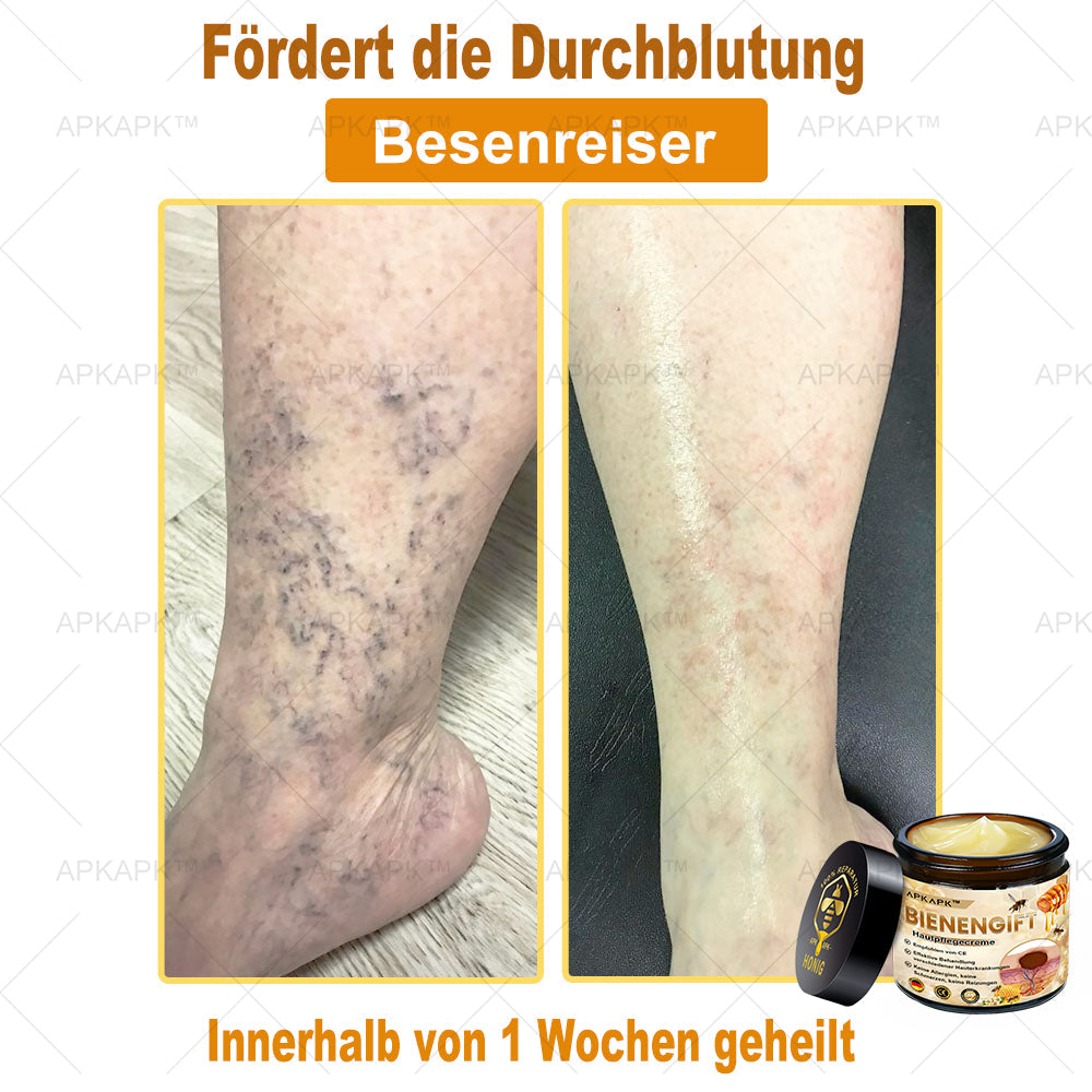 Hautgeprüfte Zertifizierung | 🥇🥇 APKAPK™ BIENENGIFT Hautpflegecreme ( 🔥Letzter Tag der Aktion 80% Rabatt)